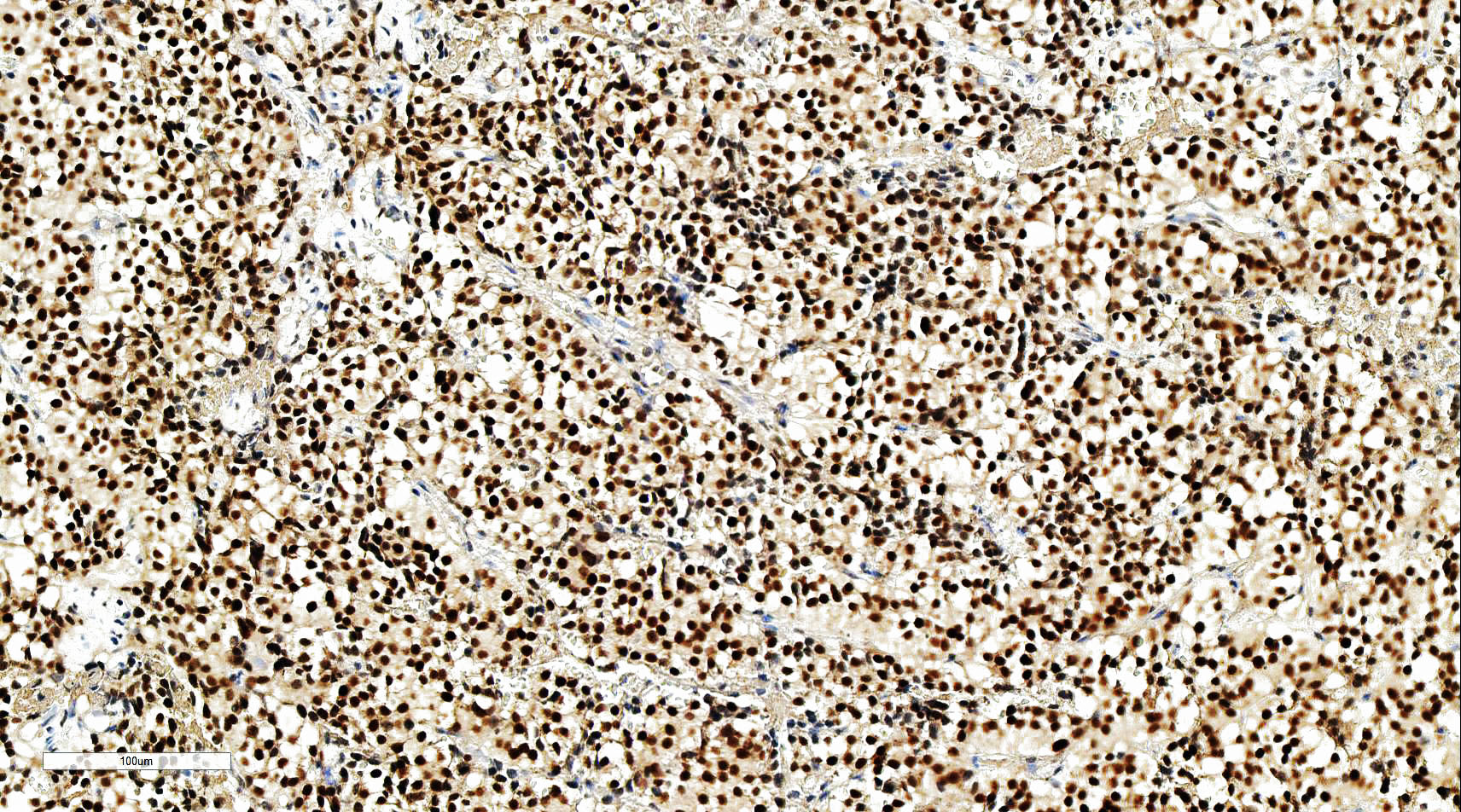 ZM-0318-6ml T-PIT抗体试剂（免疫组织化学法） - ZSGB-BIO/中杉金桥