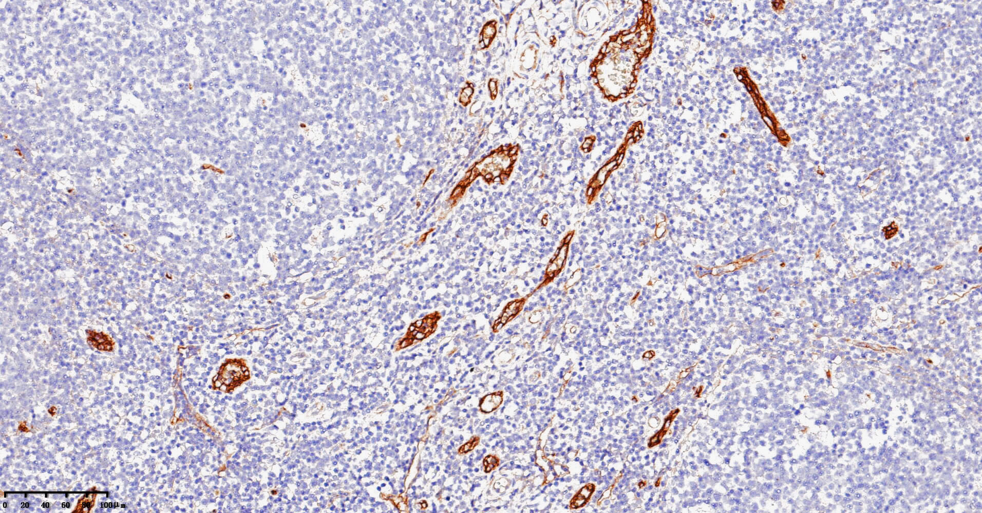 ZM-0297-1.5ml CD105 蛋白 - ZSGB-BIO/中杉金桥