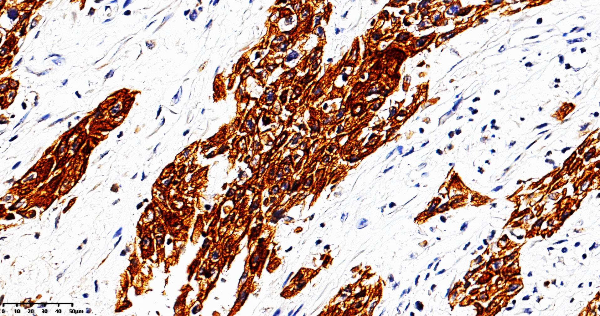ZM-0067-0.2ml CK（AE1）抗体试剂-0.2ml - ZSGB-BIO/中杉金桥