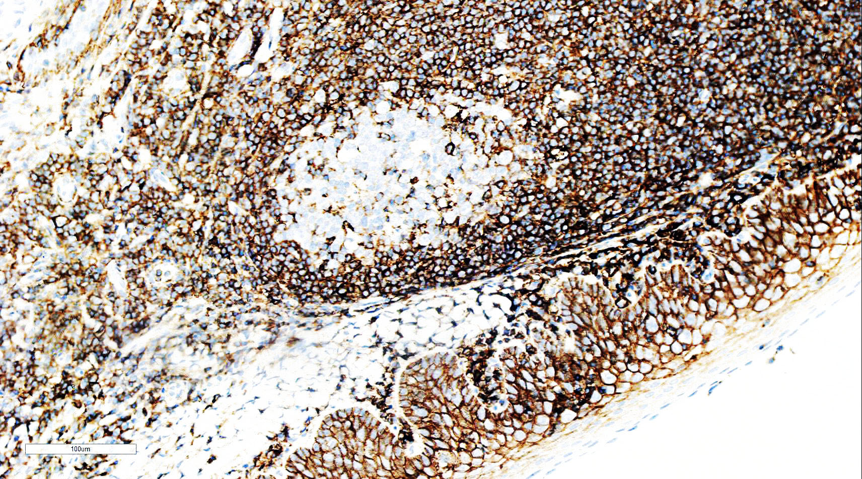 ZM-0051-6ml CD44抗体试剂（免疫组织化学）