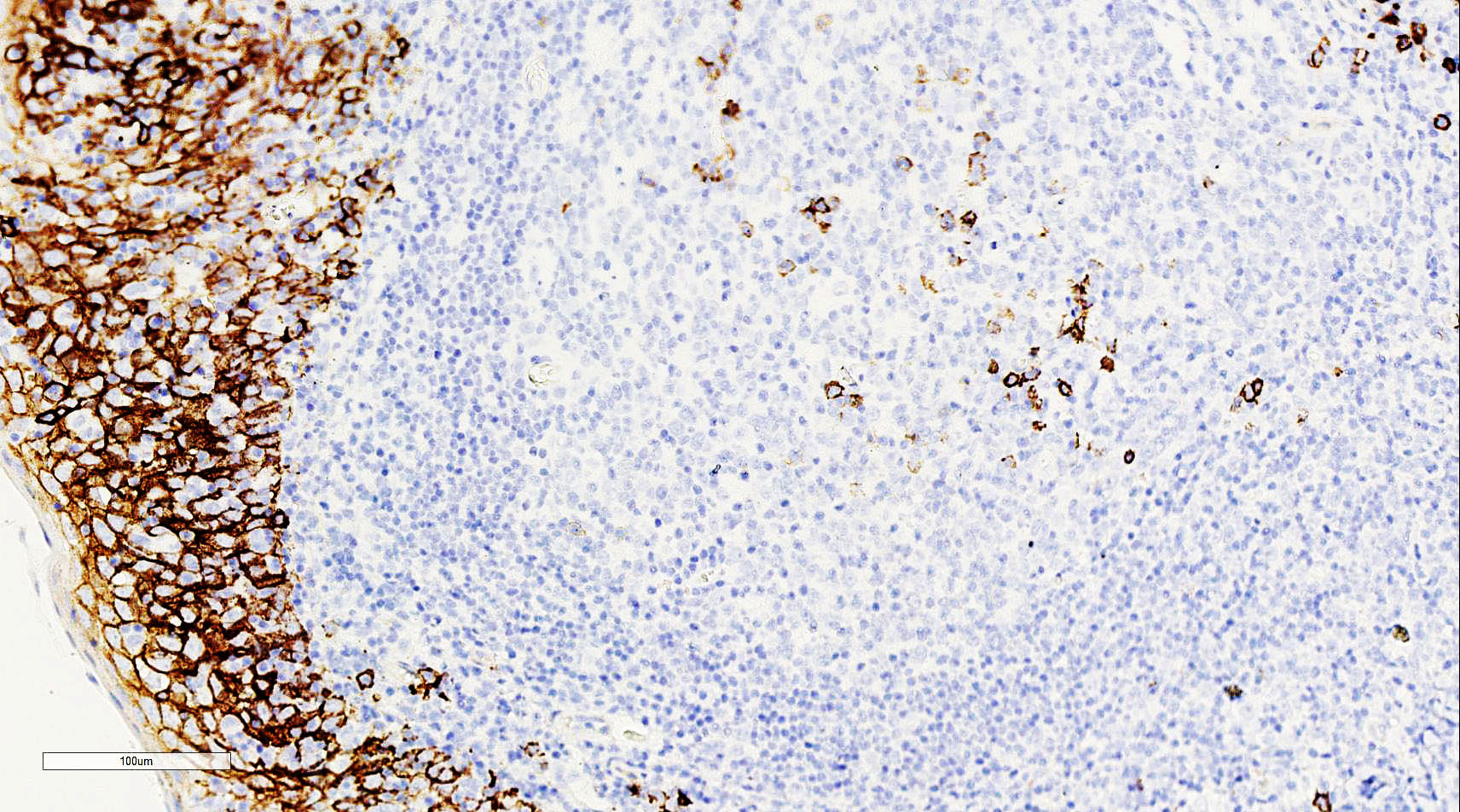 ZA-0584-0.2ml CD138蛋白