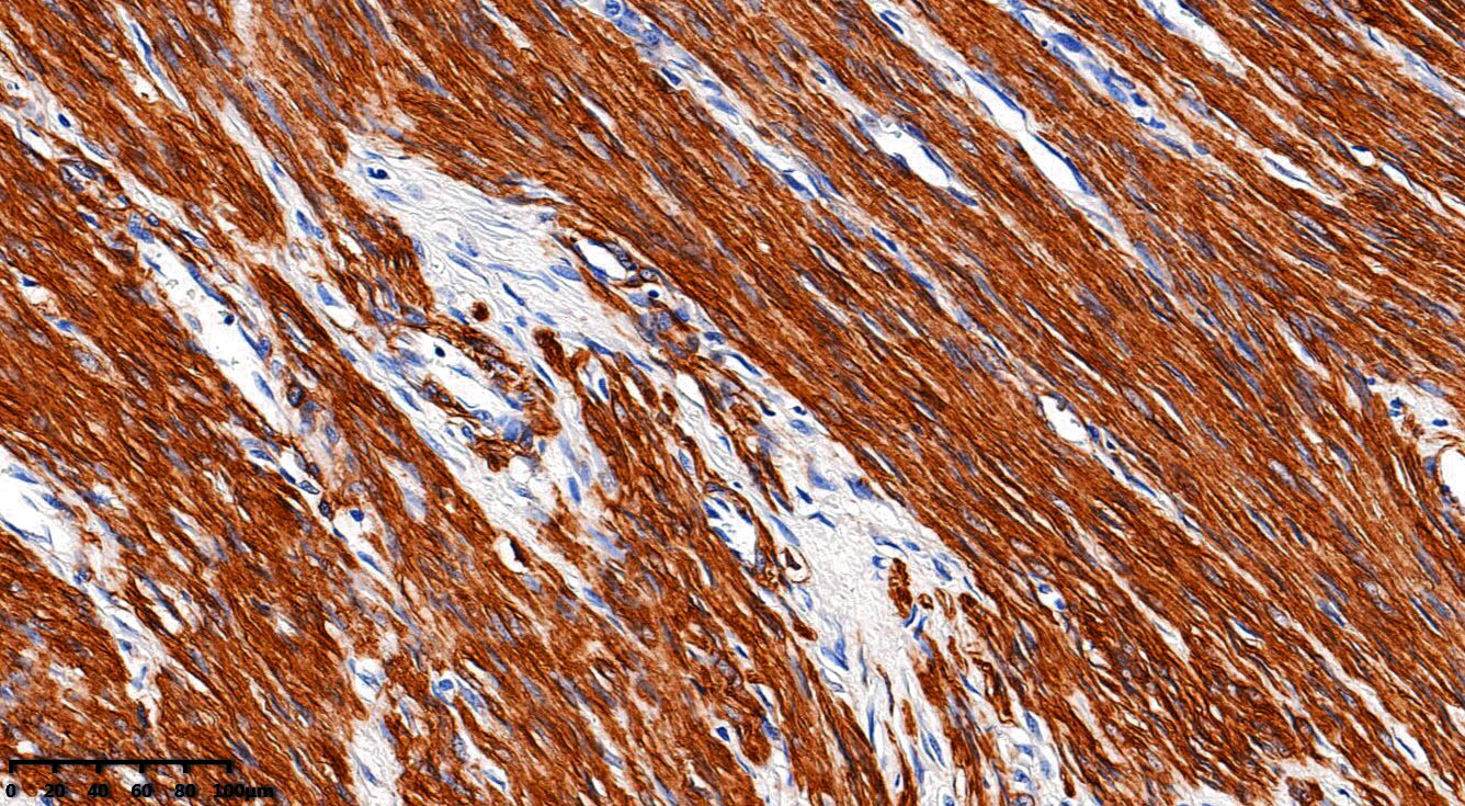 ZM-0001-3ml Actin(MuscleSpecific)肌动蛋白 - ZSGB-BIO/中杉金桥
