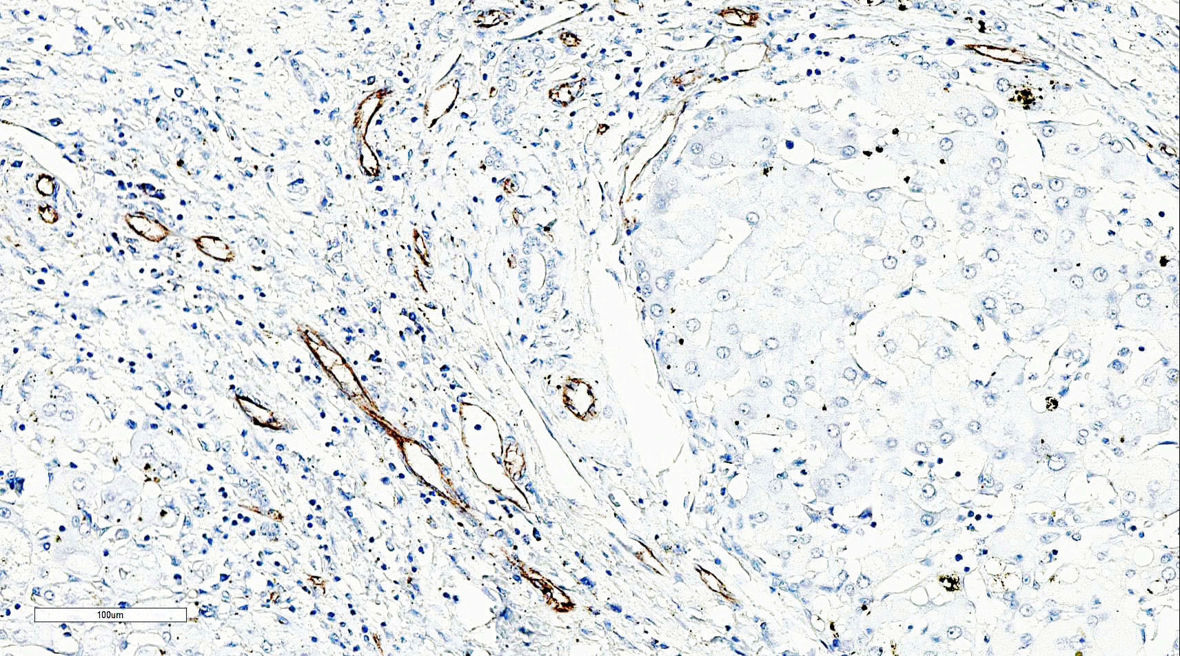 ZM-0044-1.5ml 内皮细胞 CD31 - ZSGB-BIO/中杉金桥