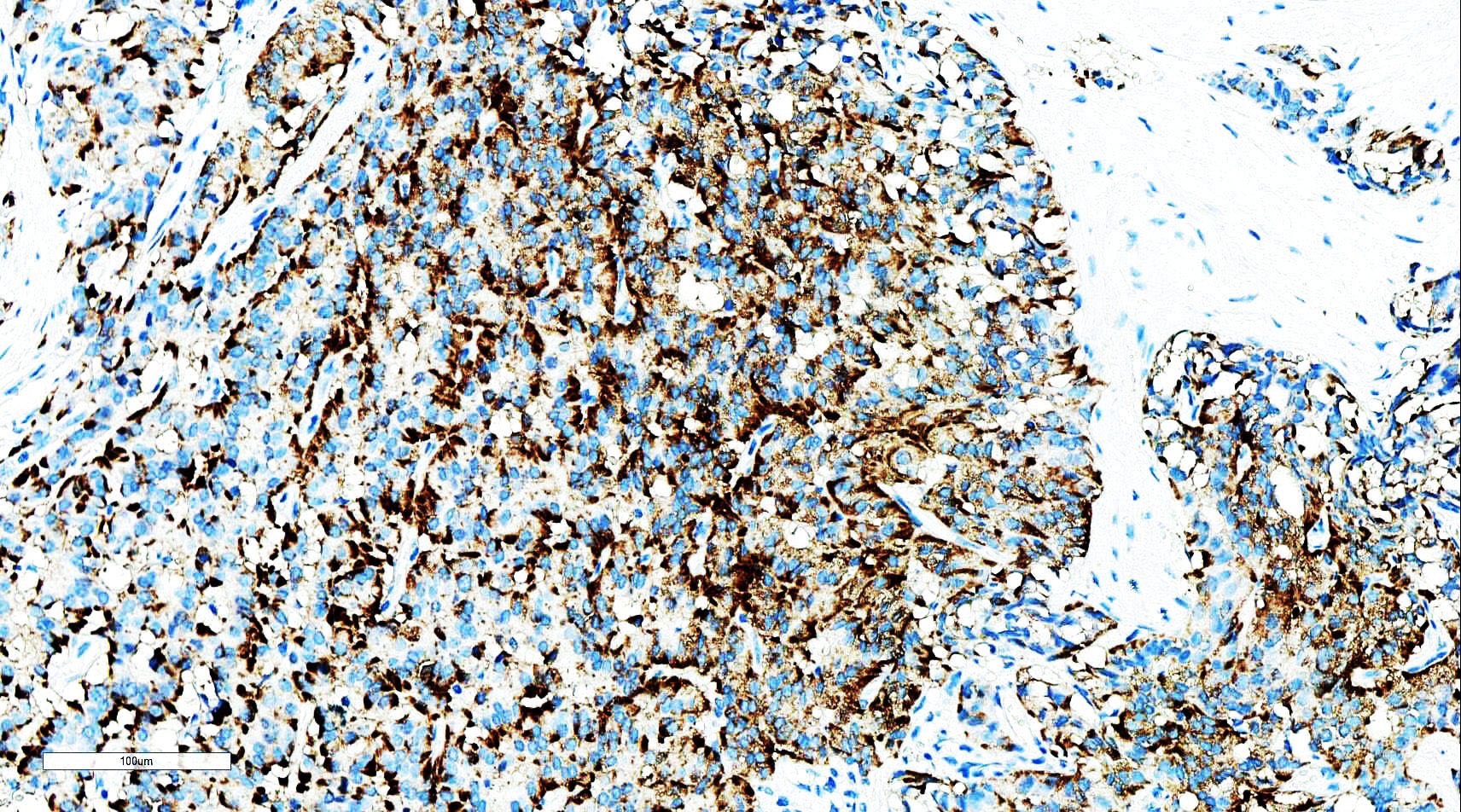 ZM-0076-6ml 嗜铬素 A Chromogranin A