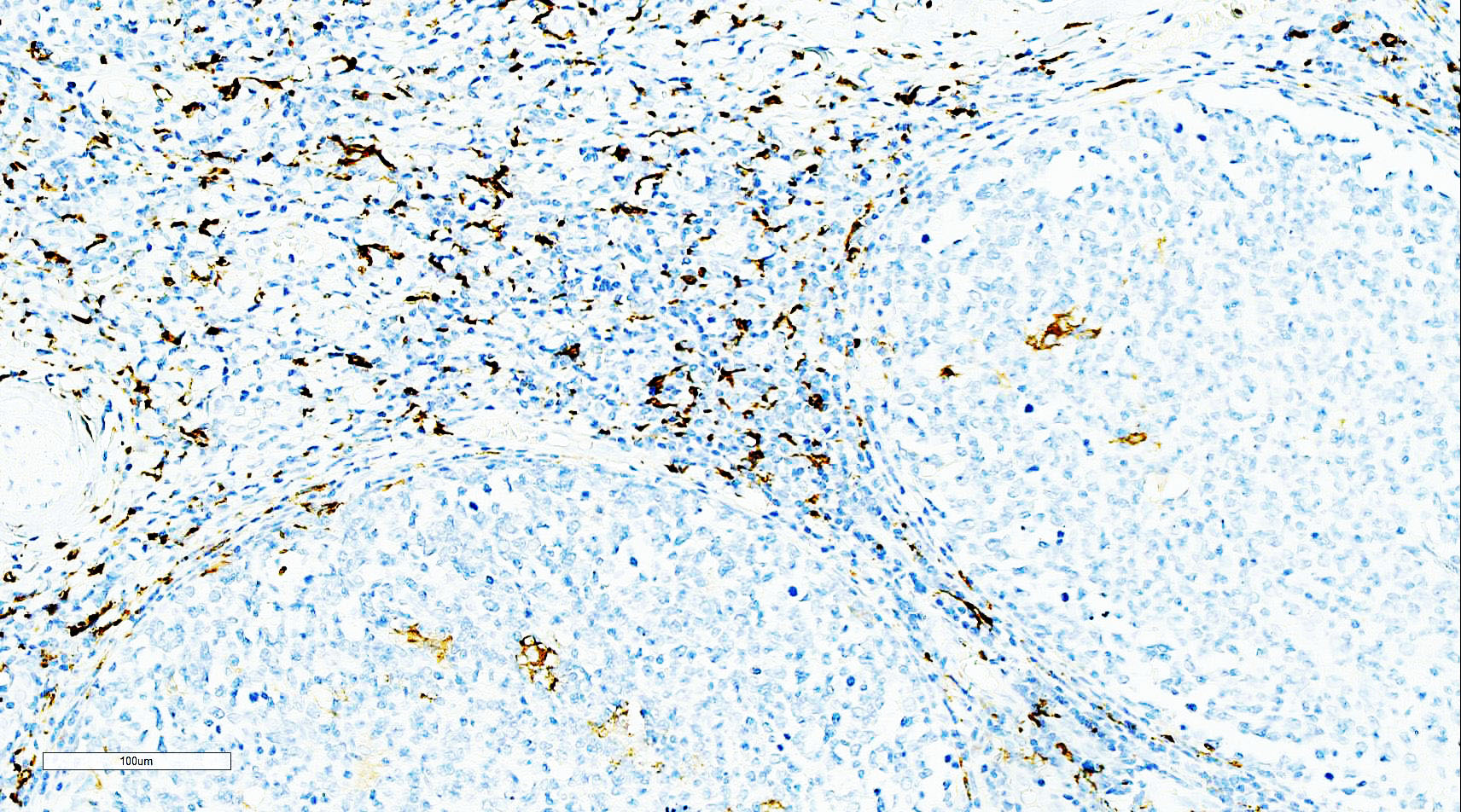 ZM-0428-3ml CD163抗体试剂（免疫组织化学） - ZSGB-BIO/中杉金桥