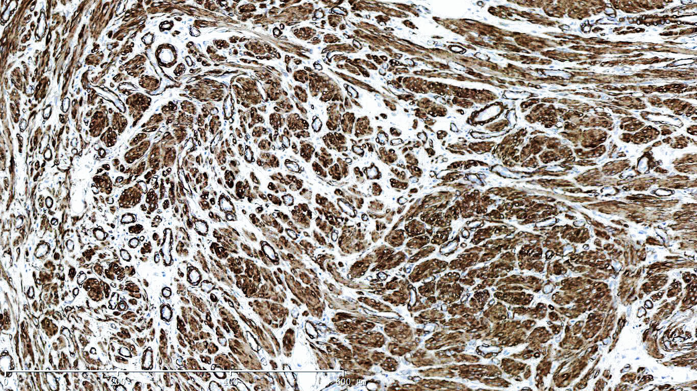 ZM-0003-0.2ml Actin(Smooth Mucle)平滑肌肌动蛋白