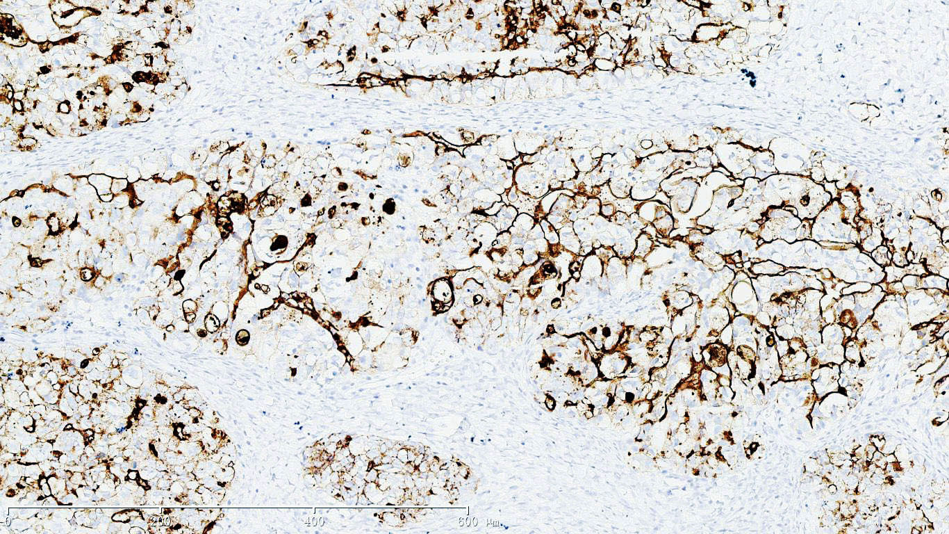 ZM-0019-6ml CA125抗体试剂