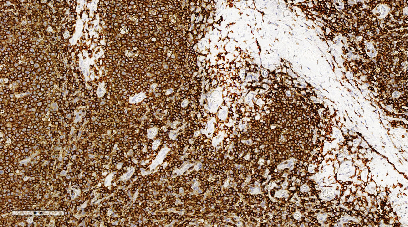 ZM-0183-3ml CD45抗体试剂（免疫组织化学）