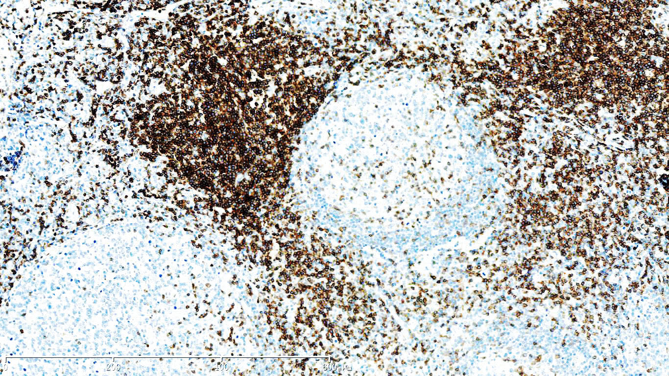 ZM-0417-0.2ml CD3抗体试剂 - ZSGB-BIO/中杉金桥