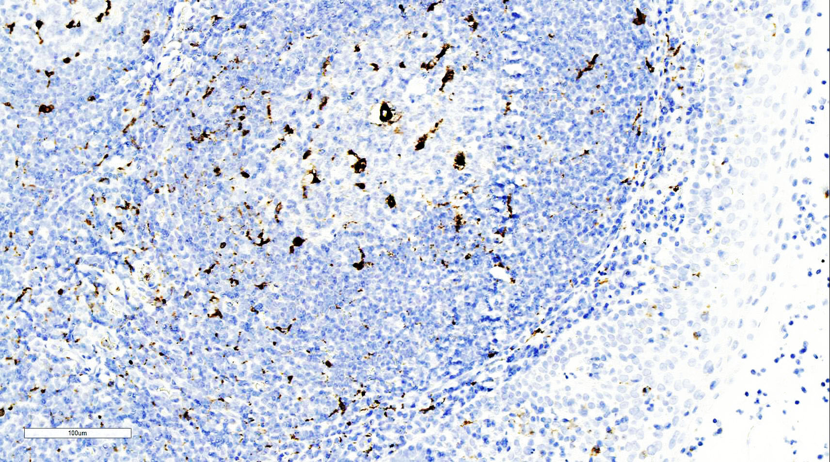 ZM-0060-6ml CD68抗体试剂 - ZSGB-BIO/中杉金桥