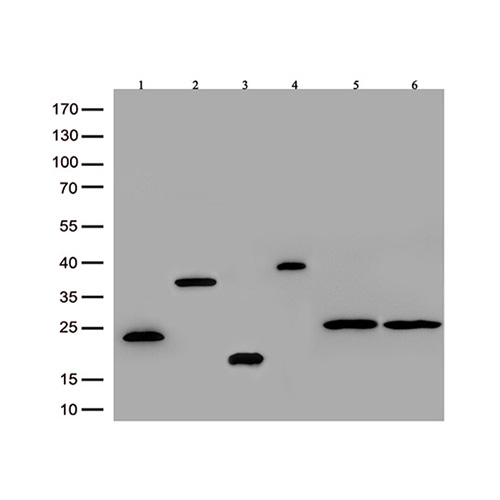 TA592569 DDK 兔单克隆抗体, recognizing both N- and C-terminal tags - OriGene