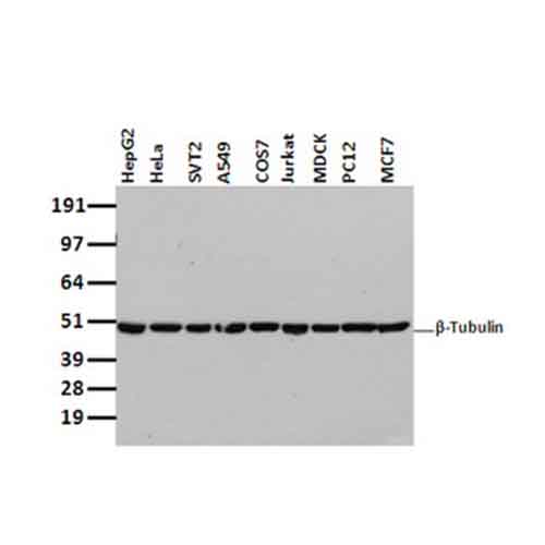 TA503129 beta Tubulin (TUBB4) 小鼠单克隆抗体 - OriGene