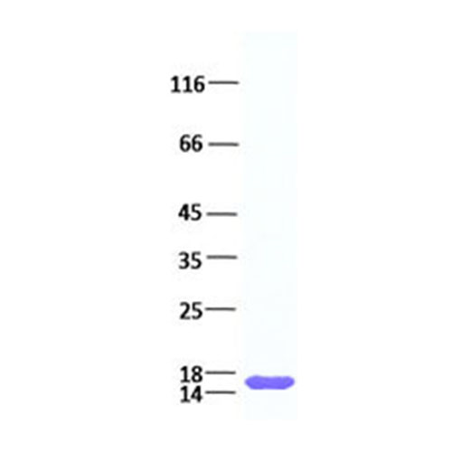 TP750001 FGF1 (NM_000800) 人重组蛋白 - OriGene