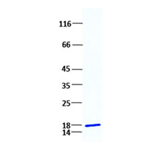 TP750004 RAIL (TNFSF10) (NM_003810) 人重组蛋白 - OriGene