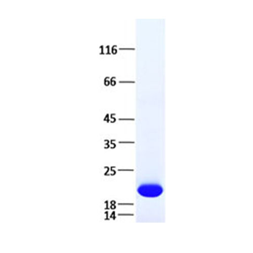 TP750006 IL6 (NM_000600) 人重组蛋白 - OriGene