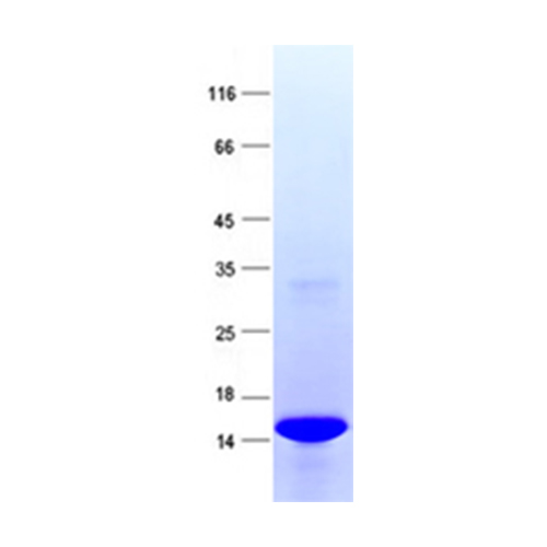 TP790117 IL2 (NM_000586) 人重组蛋白 - OriGene