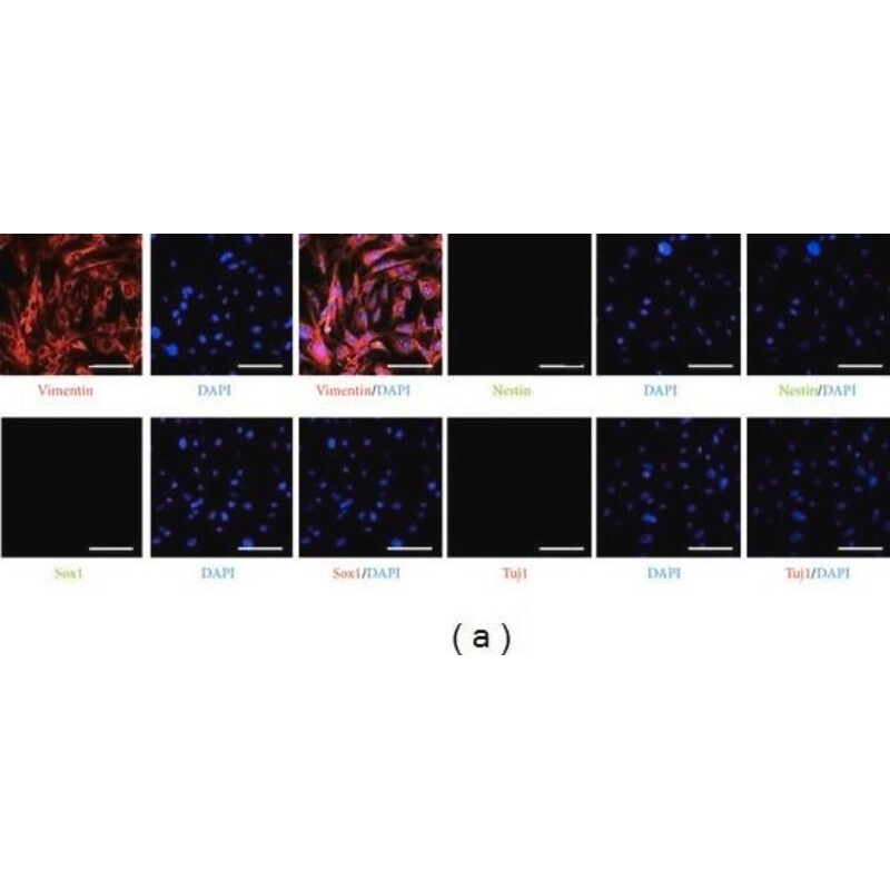 MAB5326-25UG 抗Nestin抗体 克隆10C2 - MerckMillipore/默克密理博