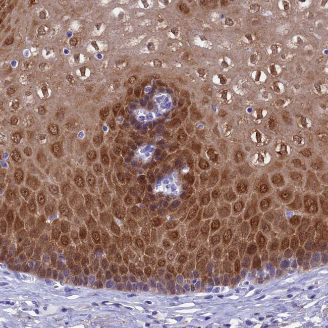 PA5-58887 抗体ADH7 Polyclonal Antibody - Gibco