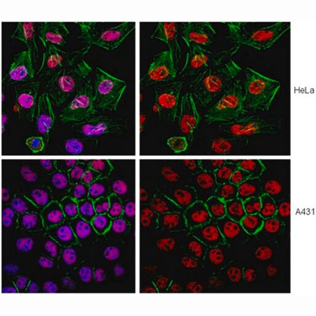 MABE121 试剂Anti-SMARCA4 Antibody clone 20C3.2 - MerckMillipore/默克密理博