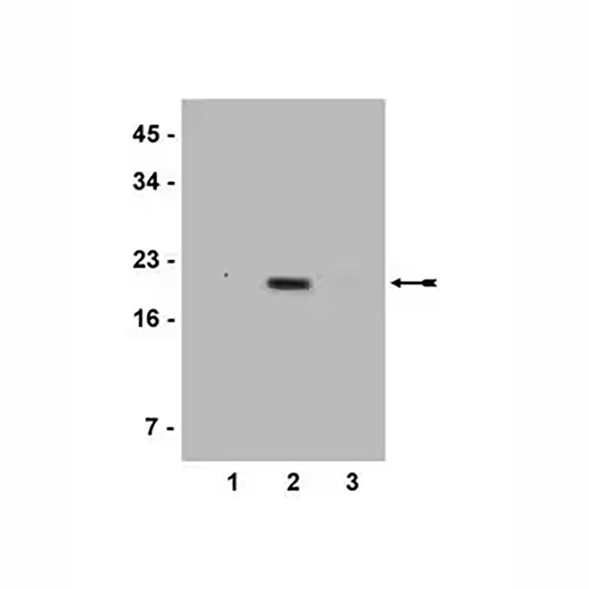 07-539 抗乙酰组蛋白H3（Lys4）抗体