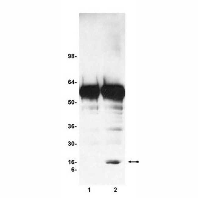17-295 染色质免疫沉淀（ChIP）检测试剂盒 - MerckMillipore/默克密理博