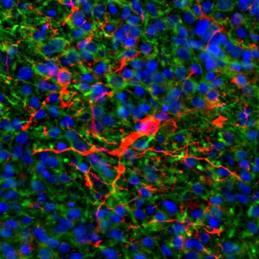 13-0300 一抗GFAP Monoclonal Antibody (2.2B10) - Invitrogen