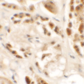 PA5-72765 一抗SIGLEC15 Polyclonal Antibody - Invitrogen