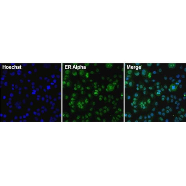 MA1-310 雌激素受体α单克隆抗体（33） - Invitrogen