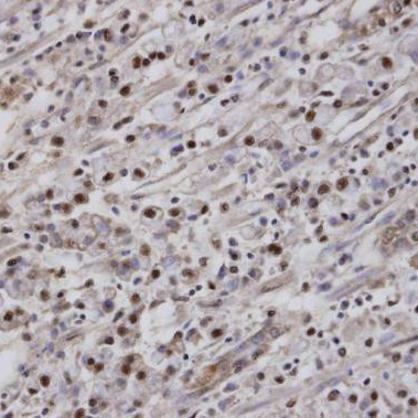 PA5-27135 一抗EAR2 Polyclonal Antibody - Invitrogen