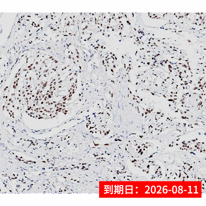 ZA-0695-6ML INSM1抗体试剂（免疫组织化学法） - ZSGB-BIO/中杉金桥