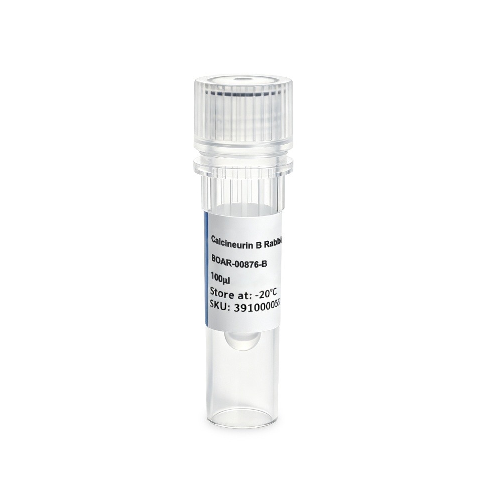 BOAR-00876-B Calcineurin B Rabbit Polyclonal抗体 - Biosharp/白鲨