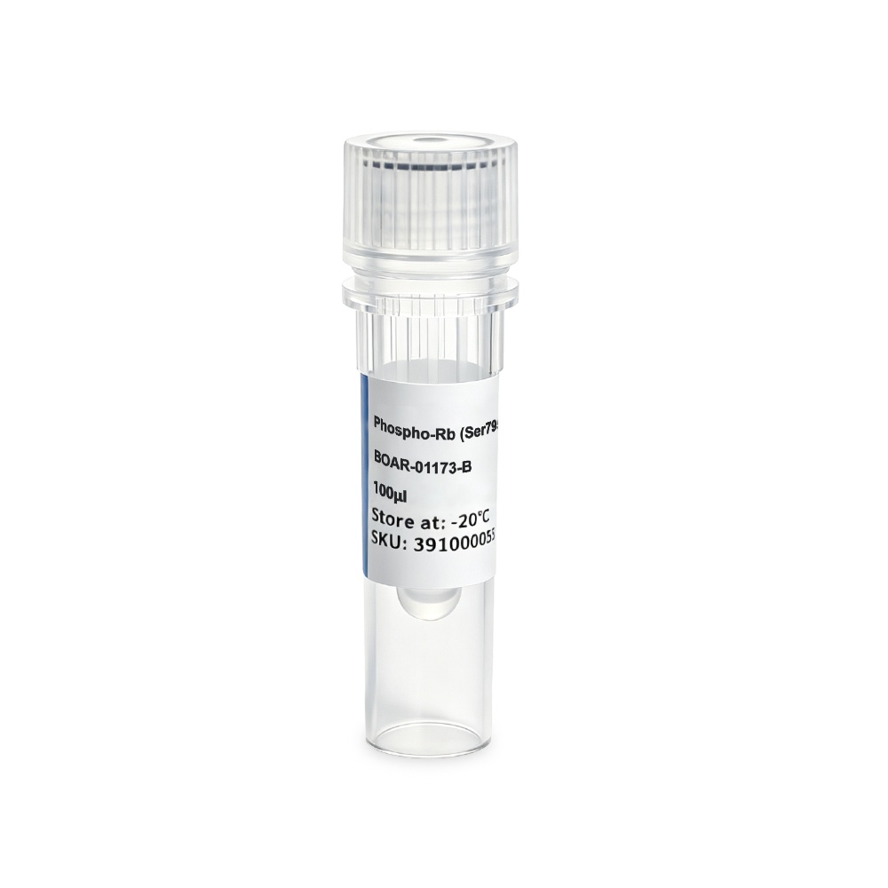 BOAR-01173-B Phospho-Rb (Ser795) Rabbit Polyclonal抗体 - Biosharp/白鲨